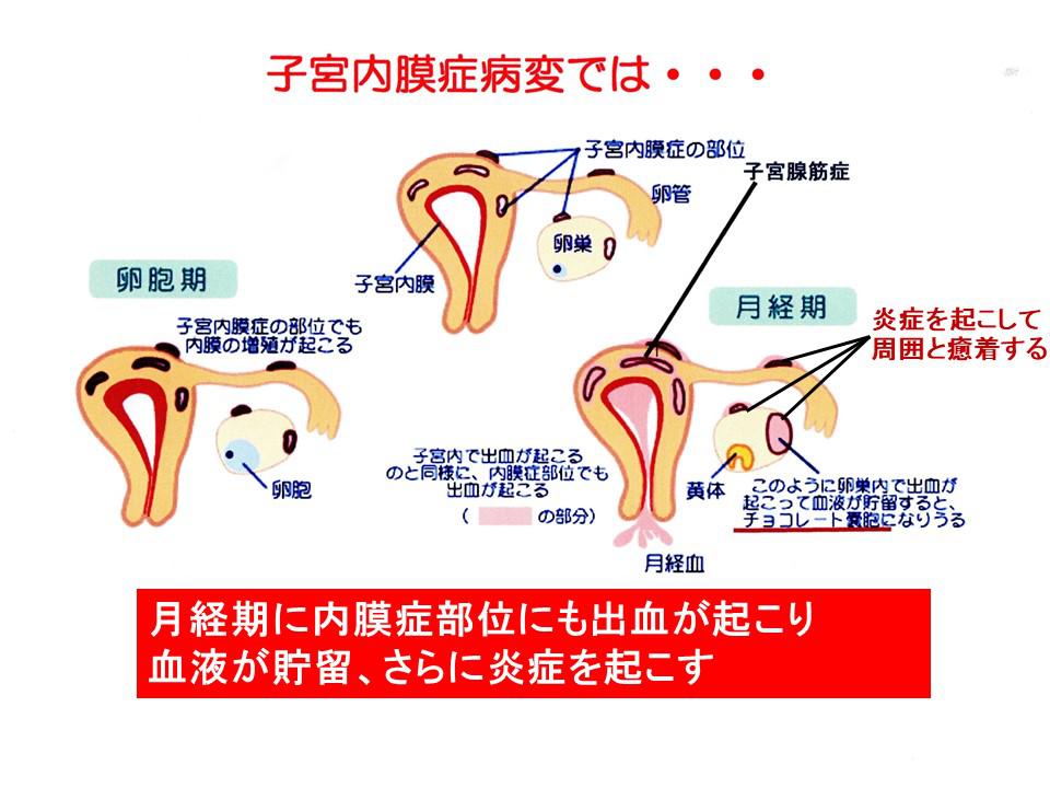 FB-一般不妊など.jpg