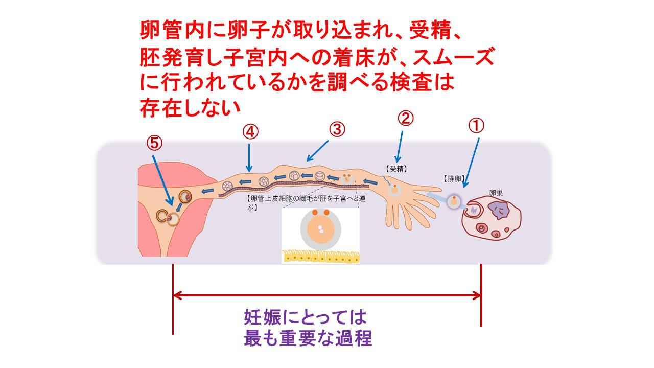 不妊原因と検査.jpg