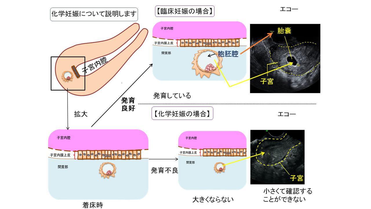 1.27　峰 最新版 妊娠や流産について知っておきたい知識.jpg