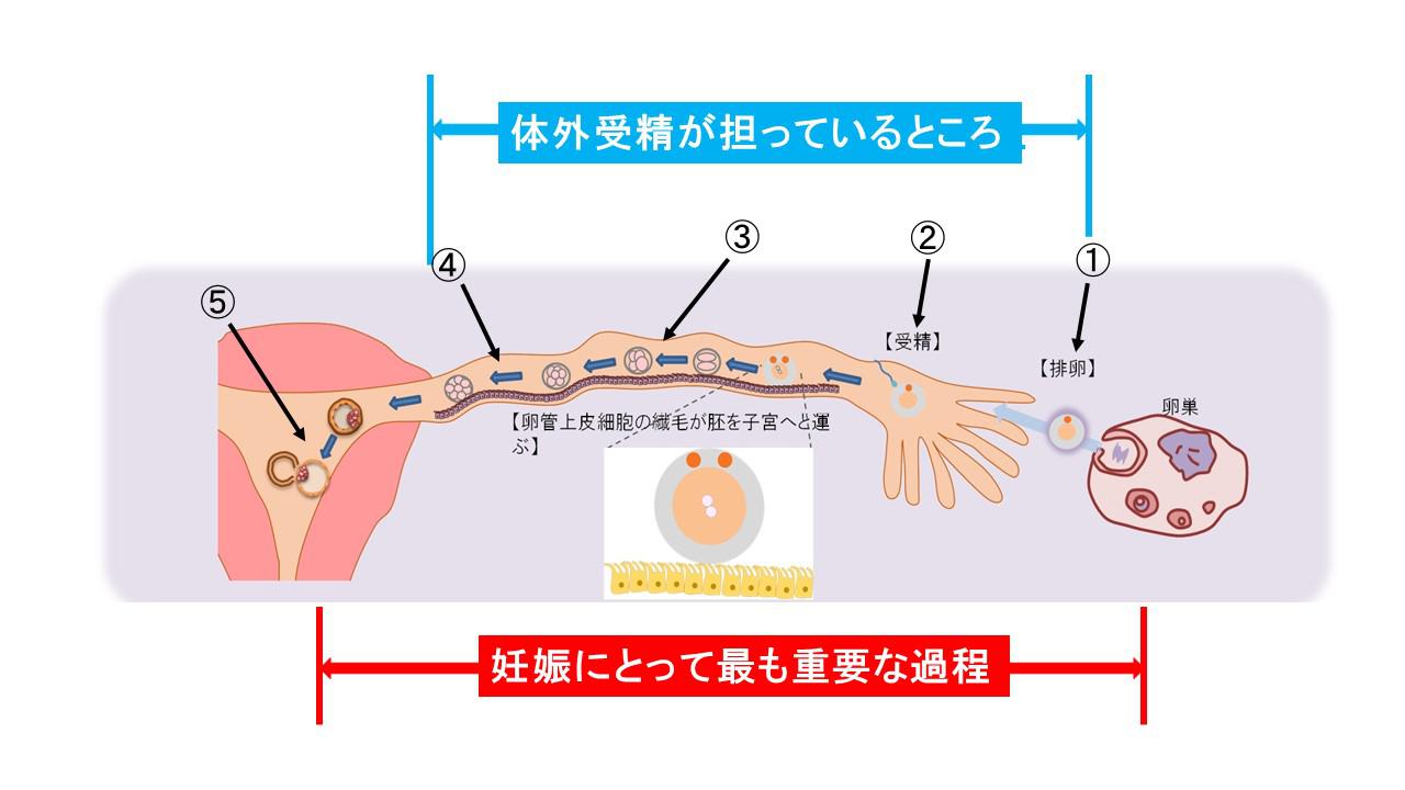 体外受精の適応３.jpg