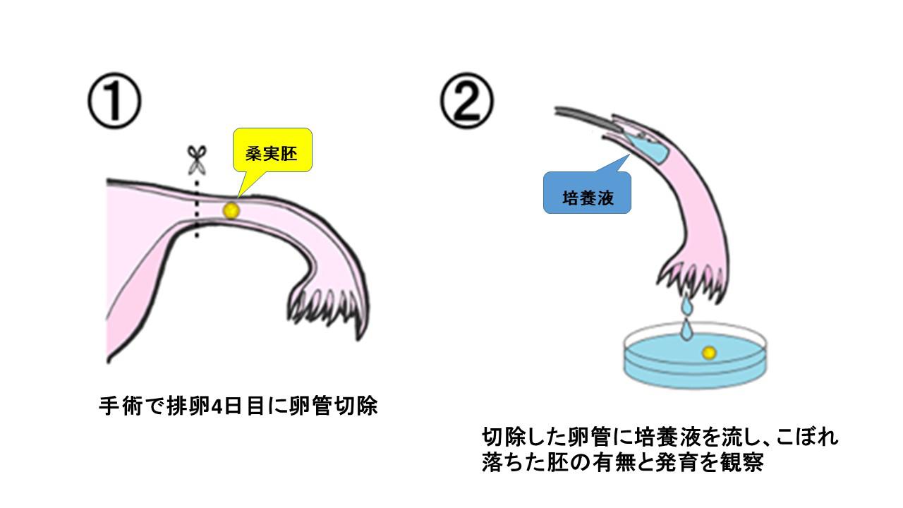 不妊原因と検査.jpg