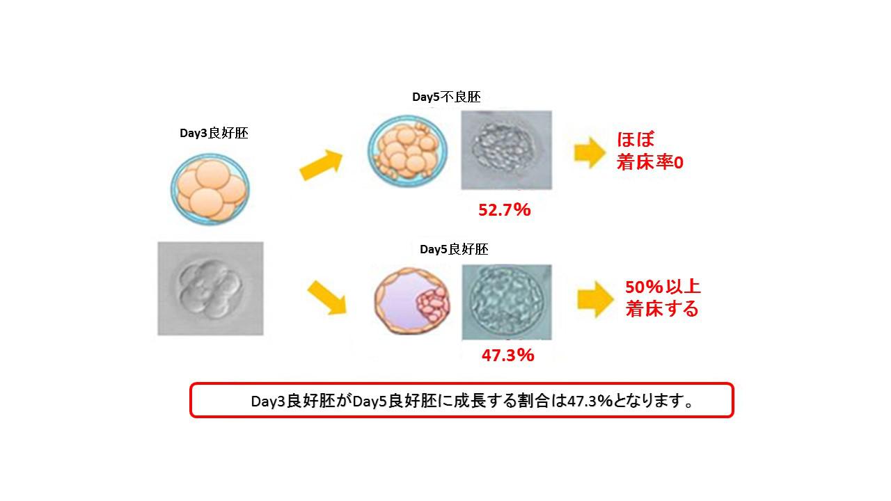 移植①.jpg