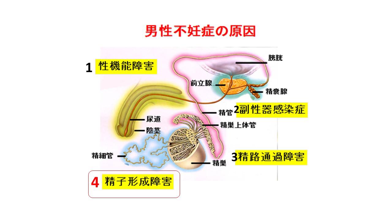 不妊原因と検査.jpg