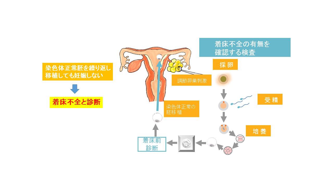 移植26.jpg