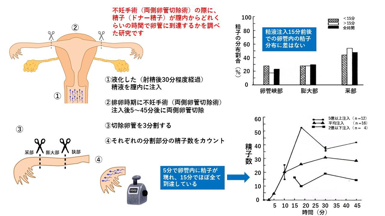 腔内から卵管への精子の移動 ① よくあるご質問 徐クリニック