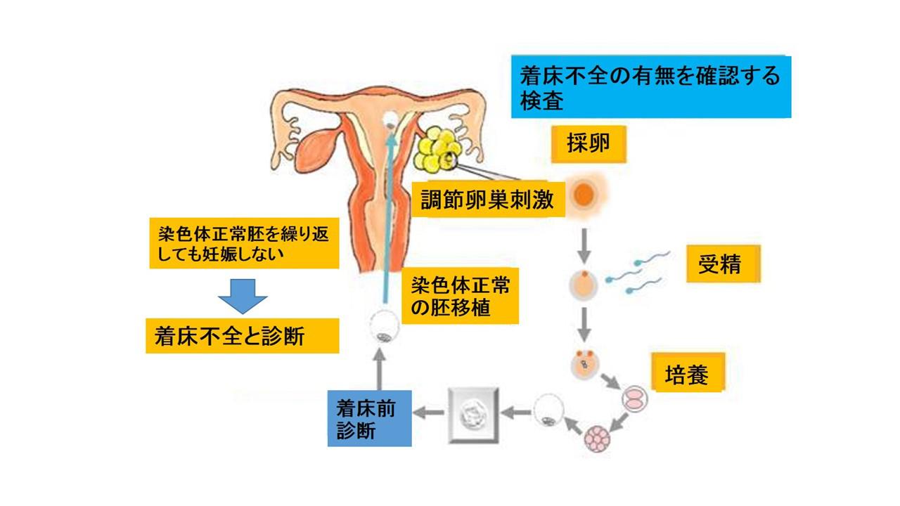 胚の染色体について～着床前診断とは？～.jpg