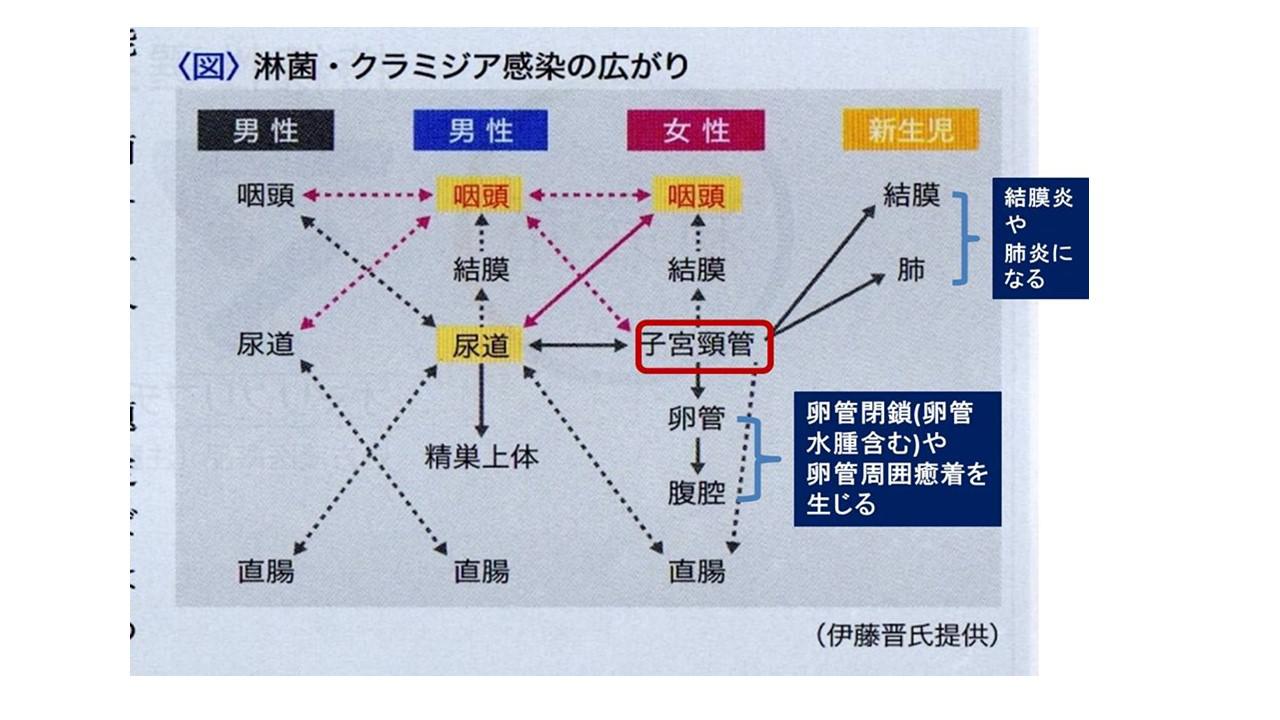 妊娠や流産について知っておきたい知識１.jpg