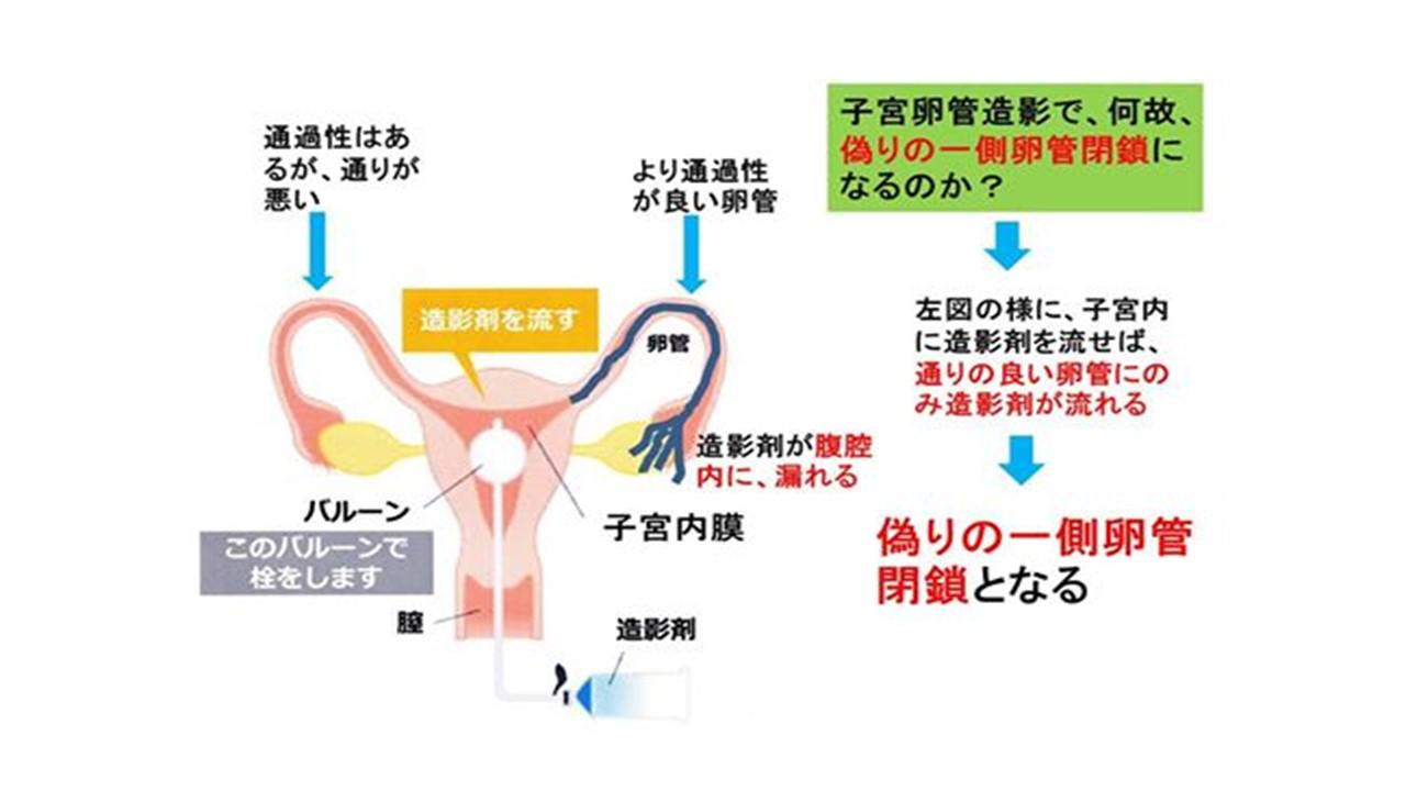 2不妊原因と検査.jpg