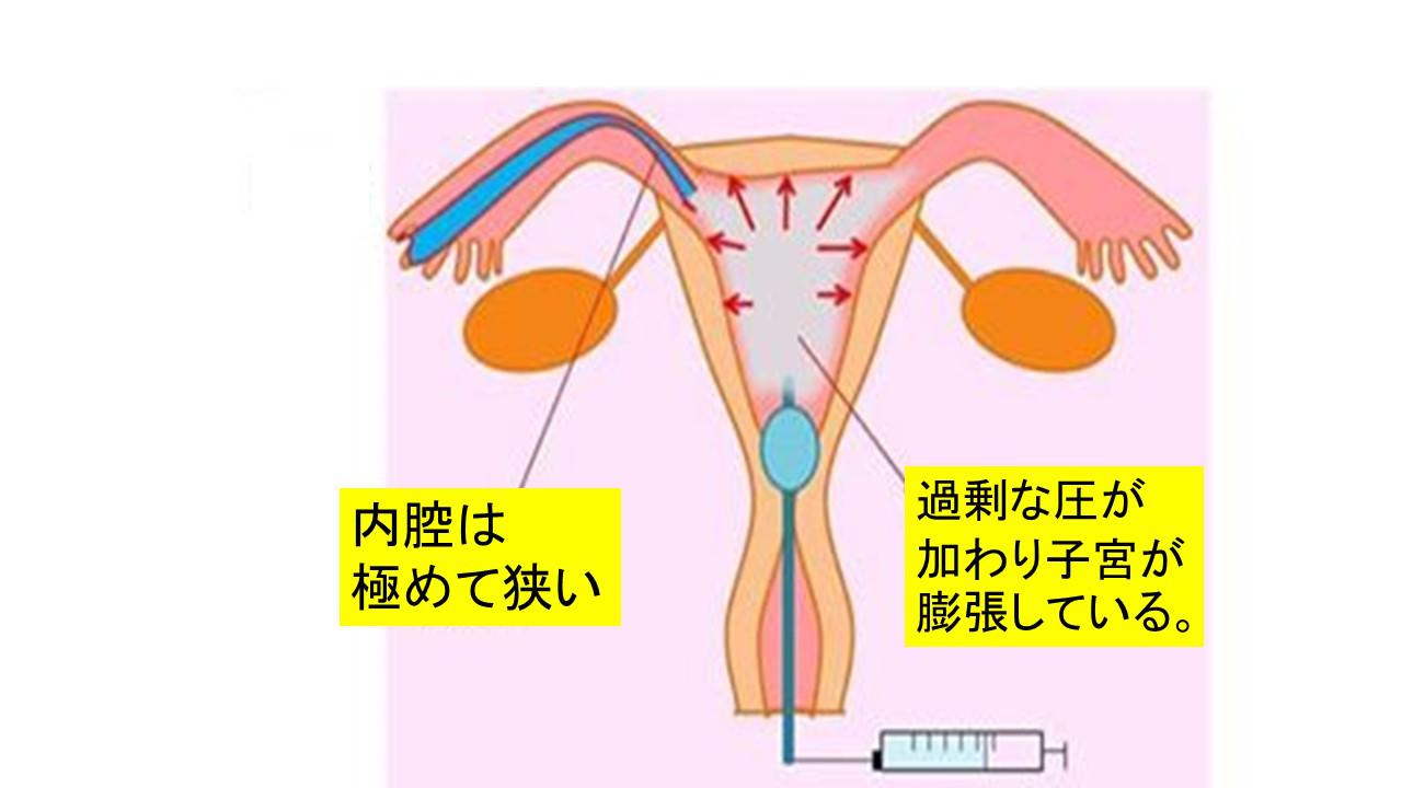 不妊原因と検査.jpg