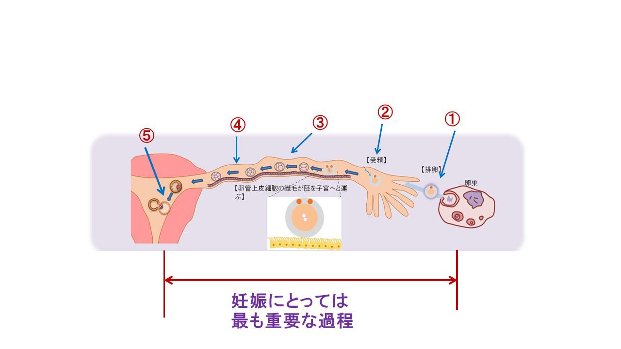 不妊原因と検査1.jpg