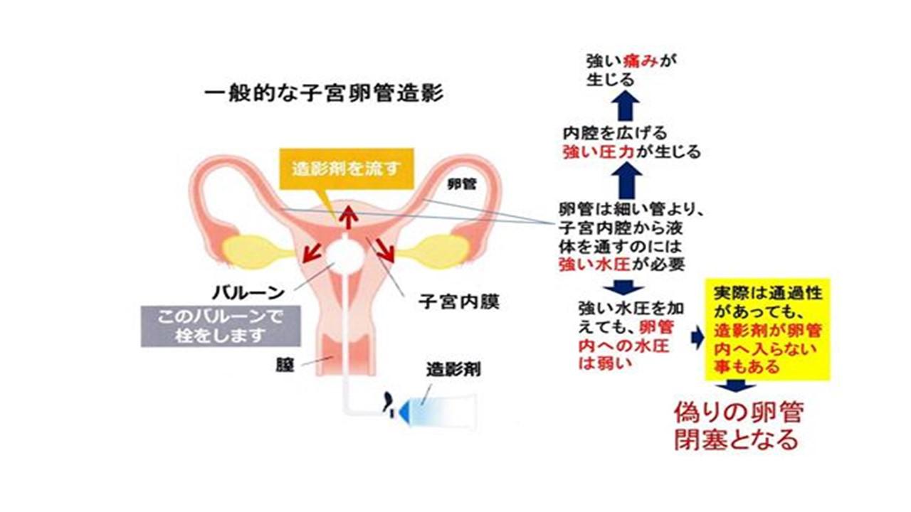 不妊原因と検査.jpg